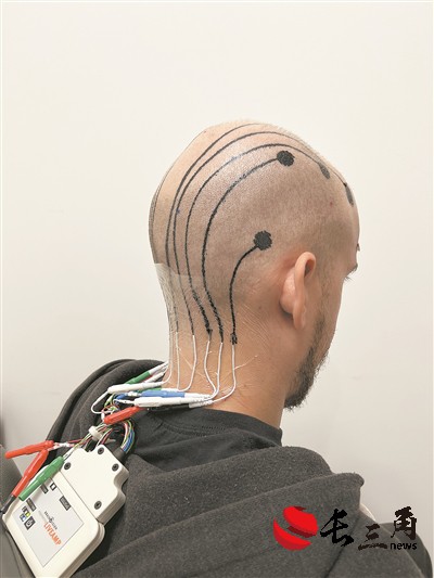 2025媒体管家:“电子墨水”可监测脑电波 有望拓展非侵入式脑机接口技术应用